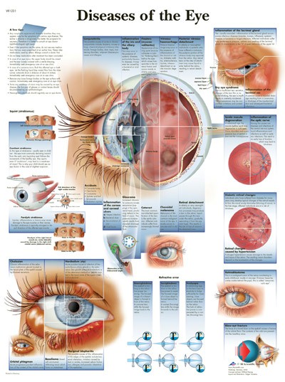 Diseases Of The Eye