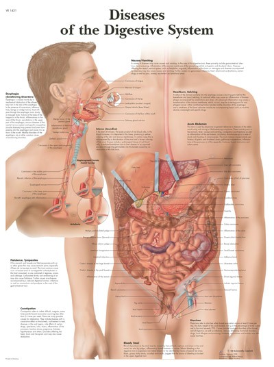 Diseases Of The Digestive System