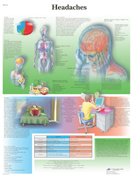 Wandkaart: Headaches